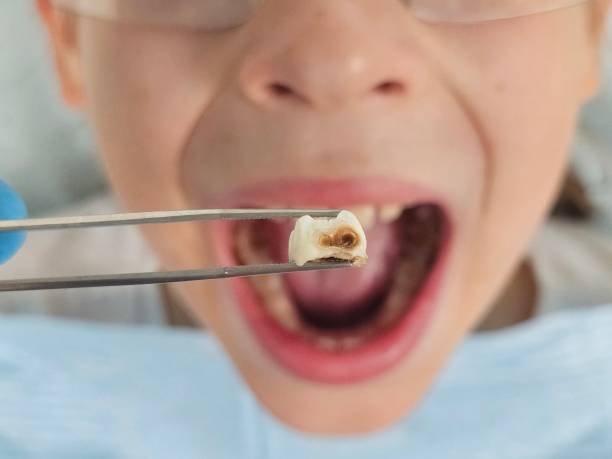 Best Broken or Cracked Tooth Emergency Dentist in Sterling, GA